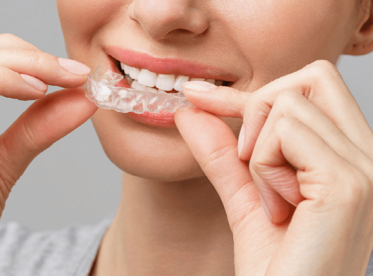 高円寺駅南口徒歩2分の歯医者、高円寺PAL歯科医院のインプラント治療の流れ