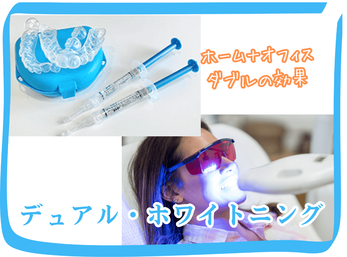 高円寺駅南口徒歩2分の歯医者、高円寺PAL歯科医院のホワイトニング