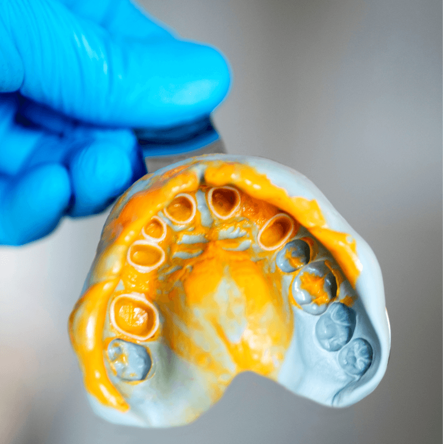 高円寺駅南口徒歩2分の歯医者、高円寺PAL歯科医院のインプラント治療の流れ