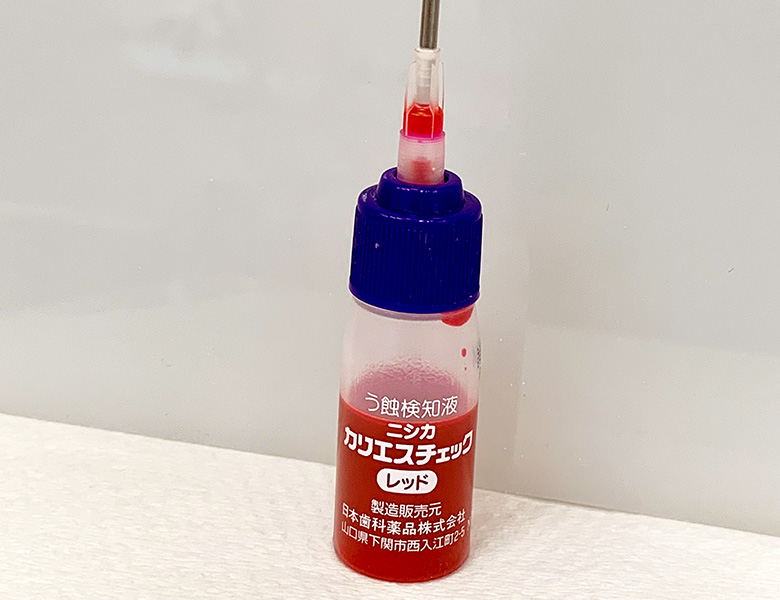 高円寺駅南口徒歩2分の歯医者、高円寺PAL歯科医院の歯を残す治療