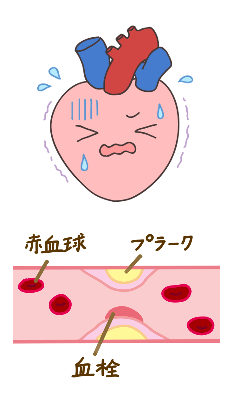 高円寺駅南口徒歩2分の歯医者、高円寺PAL歯科医院の歯周病治療