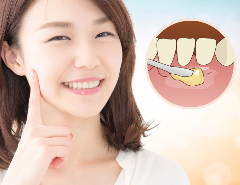 高円寺駅南口徒歩2分の歯医者、高円寺PAL歯科医院の